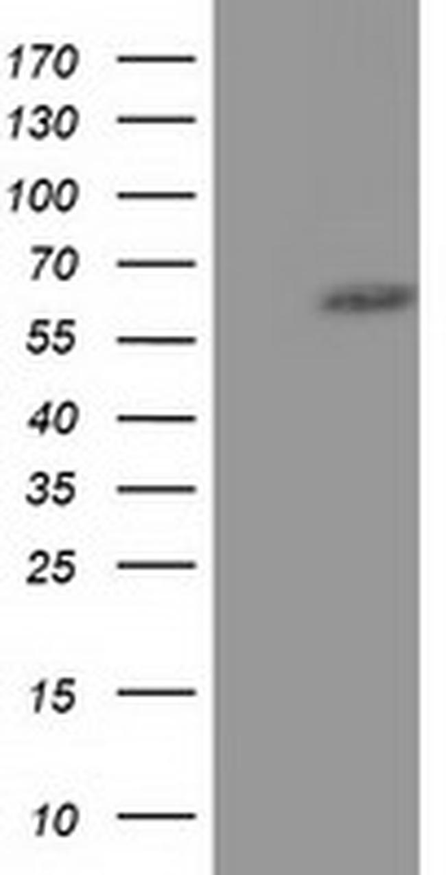 KLHL2 Antibody in Western Blot (WB)