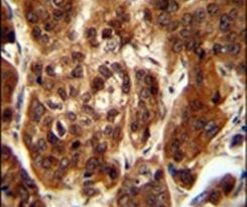 KLHL23 Antibody in Immunohistochemistry (IHC)