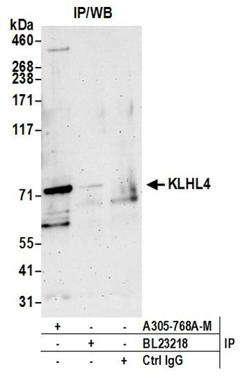 KLHL4 Antibody in Immunoprecipitation (IP)