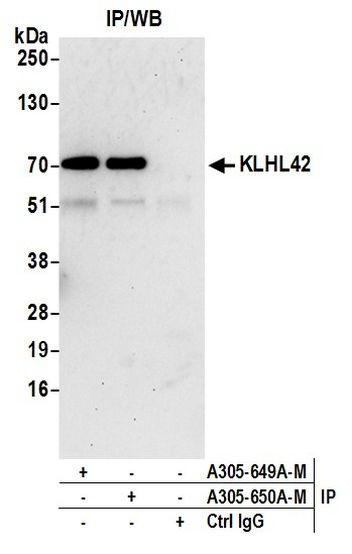 KLHL42 Antibody in Immunoprecipitation (IP)