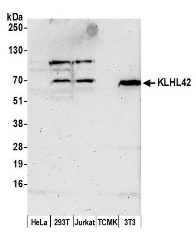 KLHL42 Antibody in Western Blot (WB)