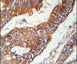 KLHL6 Antibody in Immunohistochemistry (IHC)