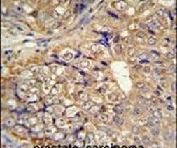 KLHL9 Antibody in Immunohistochemistry (IHC)