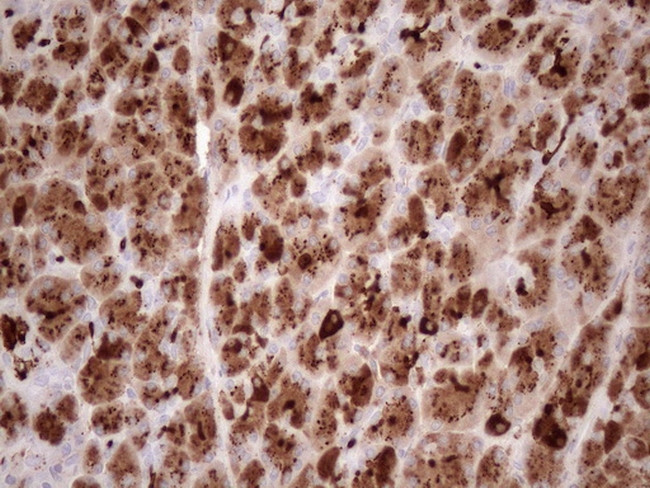 KLK3 Antibody in Immunohistochemistry (Paraffin) (IHC (P))