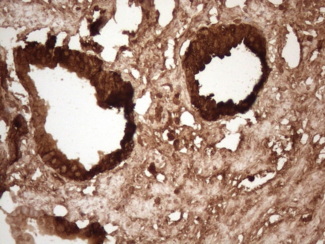 KLK3 Antibody in Immunohistochemistry (Paraffin) (IHC (P))