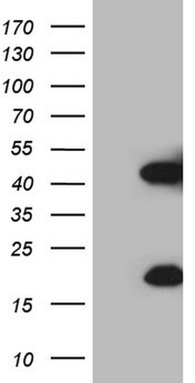 KLK3 Antibody in Western Blot (WB)