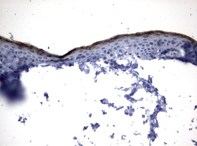 KLK8 Antibody in Immunohistochemistry (Paraffin) (IHC (P))