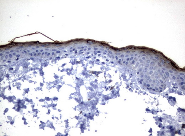 KLK8 Antibody in Immunohistochemistry (Paraffin) (IHC (P))