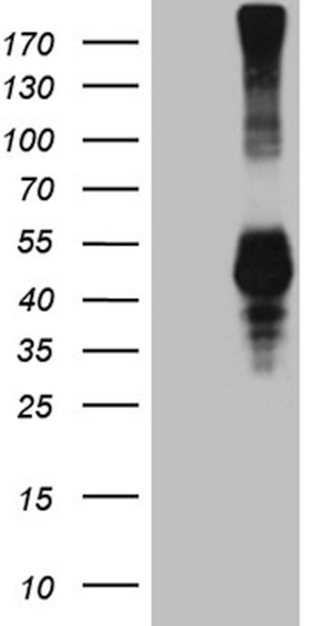 KLRB1 Antibody in Western Blot (WB)