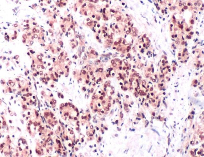 IGF2BP3 Antibody in Immunohistochemistry (IHC)