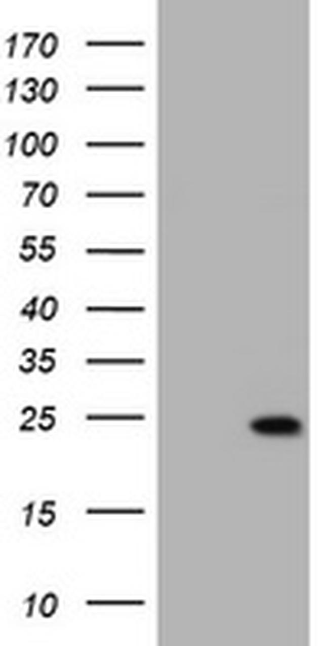 KRAS Antibody in Western Blot (WB)