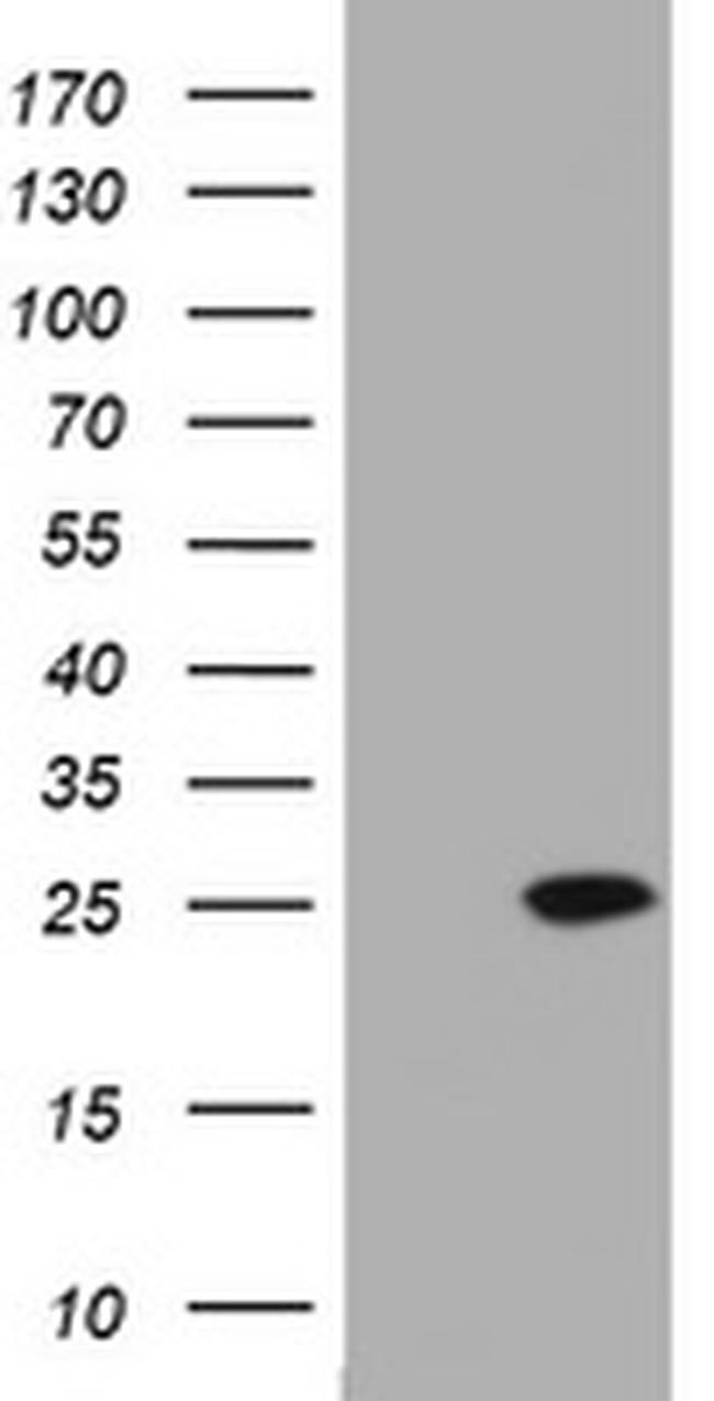 KRAS Antibody in Western Blot (WB)