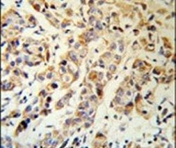 Cytokeratin 13 Antibody in Immunohistochemistry (IHC)