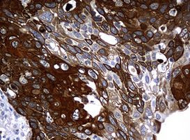 KRT14 Antibody in Immunohistochemistry (Paraffin) (IHC (P))
