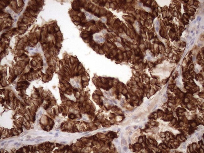 KRT16 Antibody in Immunohistochemistry (Paraffin) (IHC (P))