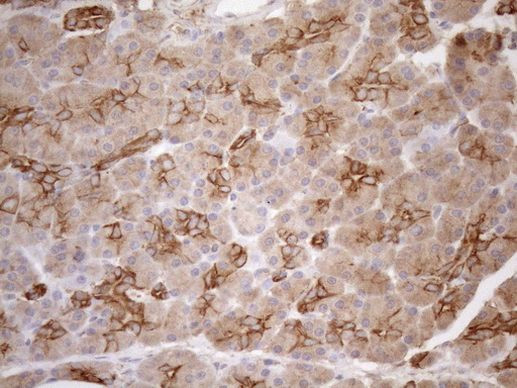 KRT16 Antibody in Immunohistochemistry (Paraffin) (IHC (P))