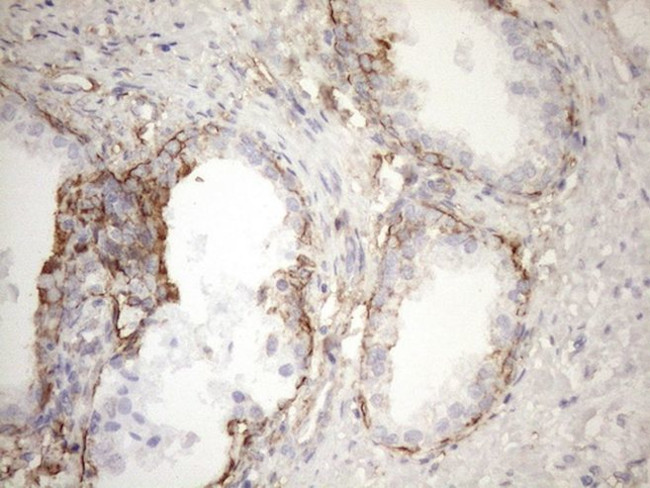 KRT16 Antibody in Immunohistochemistry (Paraffin) (IHC (P))