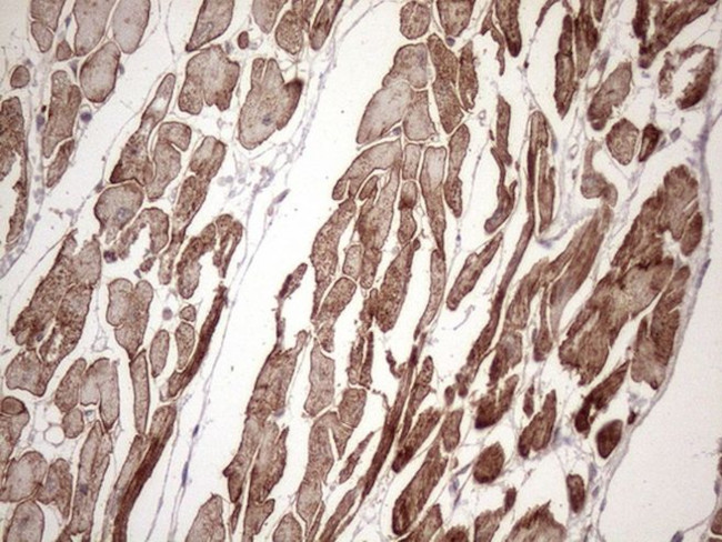 KRT16 Antibody in Immunohistochemistry (Paraffin) (IHC (P))