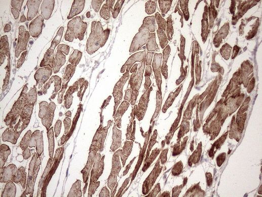 KRT16 Antibody in Immunohistochemistry (Paraffin) (IHC (P))