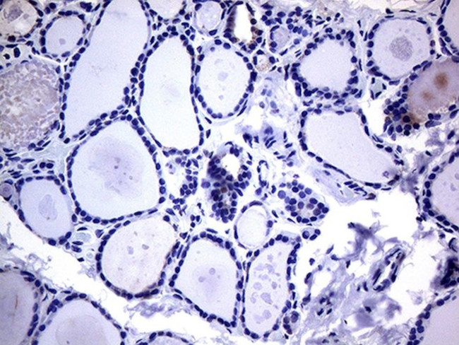 KRT16 Antibody in Immunohistochemistry (Paraffin) (IHC (P))
