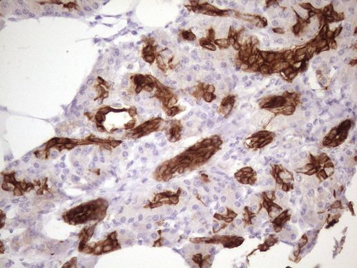 KRT16 Antibody in Immunohistochemistry (Paraffin) (IHC (P))