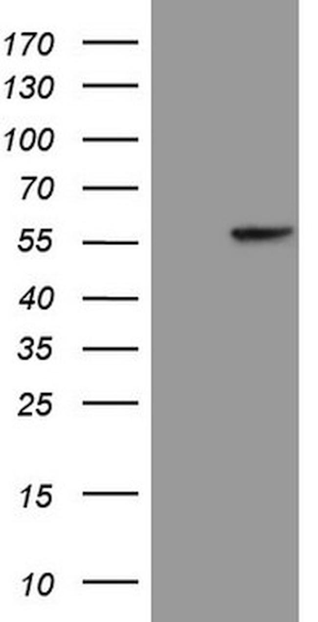 KRT16 Antibody in Western Blot (WB)