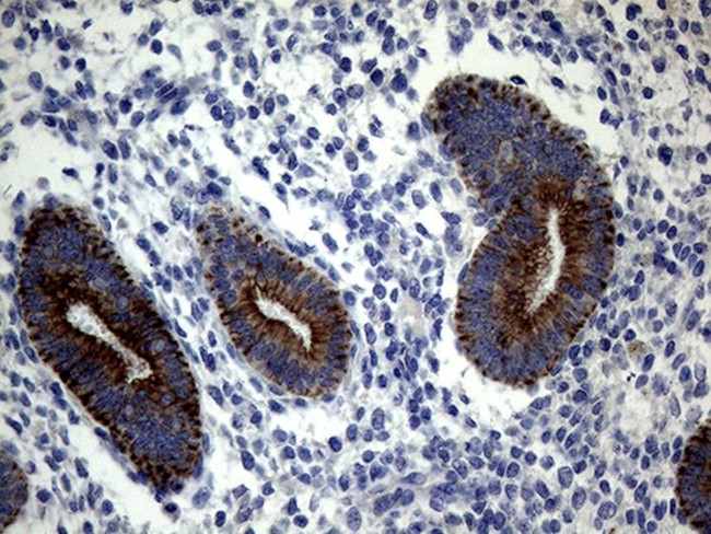 KRT18 Antibody in Immunohistochemistry (Paraffin) (IHC (P))