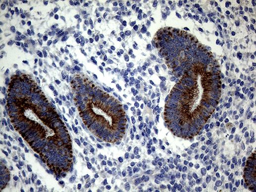 KRT18 Antibody in Immunohistochemistry (Paraffin) (IHC (P))