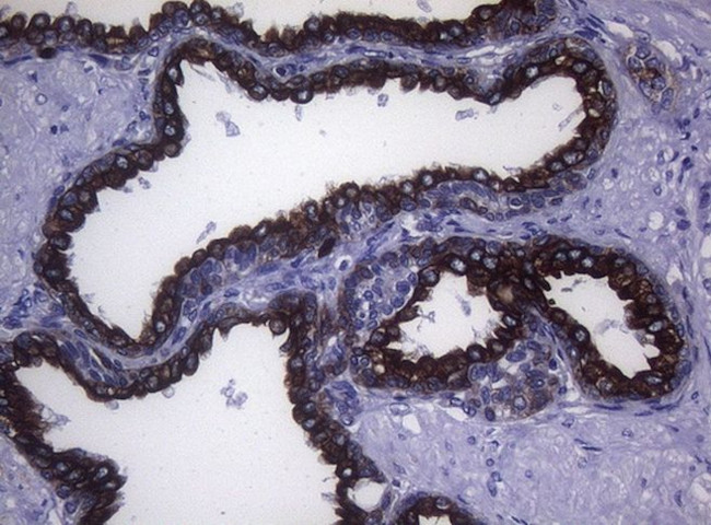 KRT18 Antibody in Immunohistochemistry (Paraffin) (IHC (P))