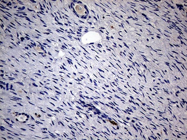 KRT18 Antibody in Immunohistochemistry (Paraffin) (IHC (P))