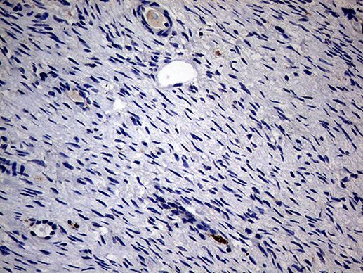 KRT18 Antibody in Immunohistochemistry (Paraffin) (IHC (P))