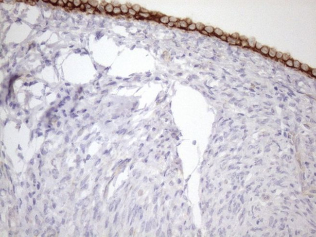 KRT18 Antibody in Immunohistochemistry (Paraffin) (IHC (P))