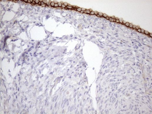KRT18 Antibody in Immunohistochemistry (Paraffin) (IHC (P))