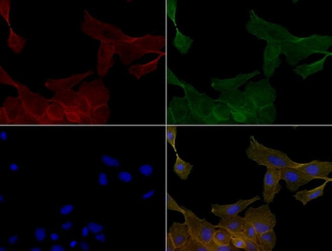 KRT19 Antibody in Immunocytochemistry (ICC/IF)