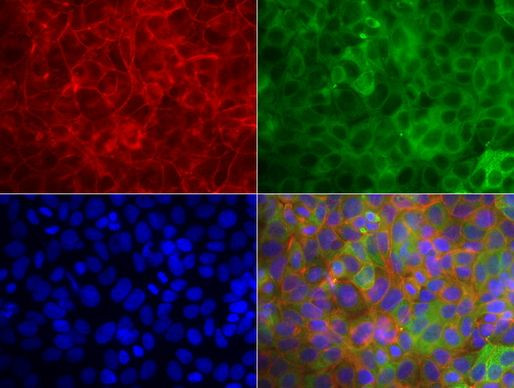 KRT19 Antibody in Immunocytochemistry (ICC/IF)