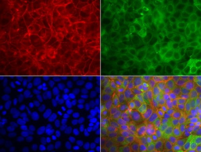 KRT19 Antibody in Immunocytochemistry (ICC/IF)