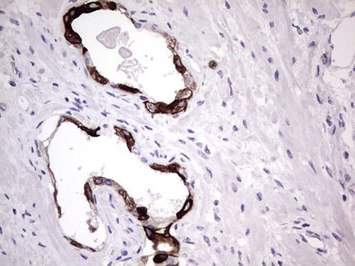 KRT19 Antibody in Immunohistochemistry (Paraffin) (IHC (P))