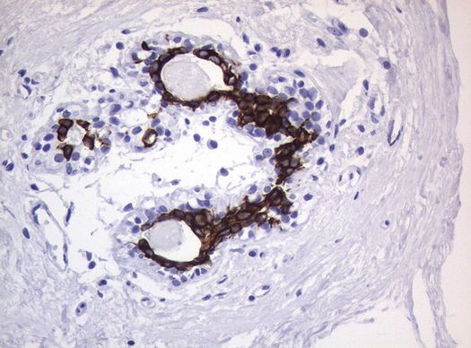 KRT19 Antibody in Immunohistochemistry (Paraffin) (IHC (P))