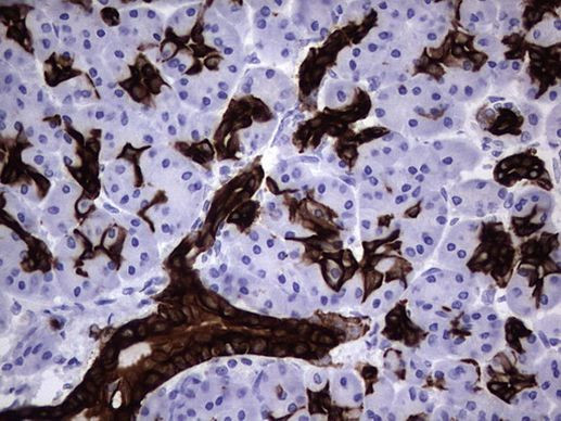 KRT19 Antibody in Immunohistochemistry (Paraffin) (IHC (P))