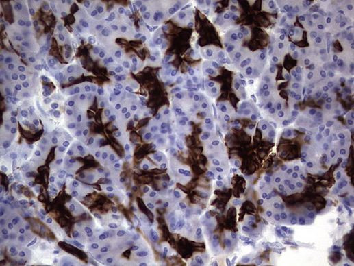 KRT19 Antibody in Immunohistochemistry (Paraffin) (IHC (P))