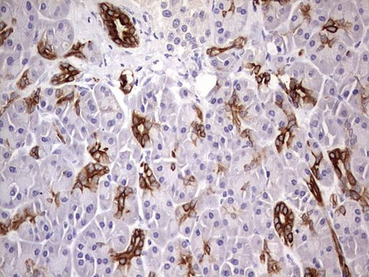 KRT19 Antibody in Immunohistochemistry (Paraffin) (IHC (P))
