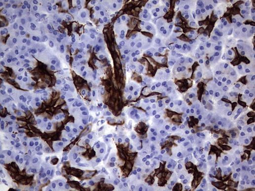 KRT19 Antibody in Immunohistochemistry (Paraffin) (IHC (P))