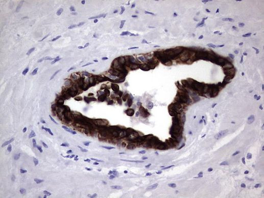 KRT19 Antibody in Immunohistochemistry (Paraffin) (IHC (P))
