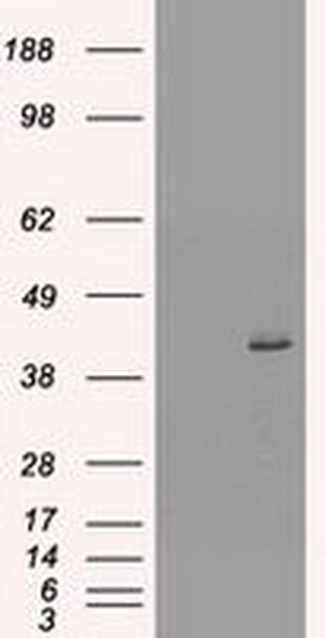 KRT19 Antibody in Western Blot (WB)