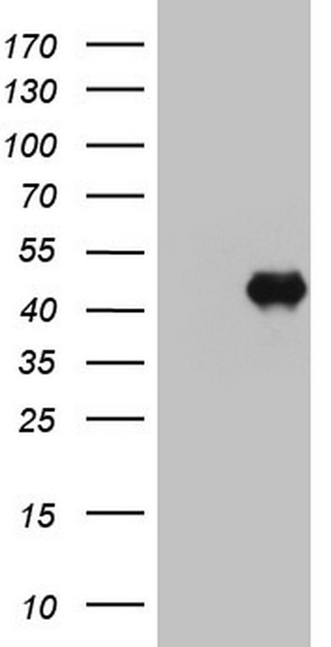 KRT19 Antibody in Western Blot (WB)