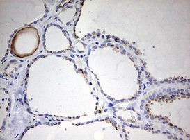 KRT20 Antibody in Immunohistochemistry (Paraffin) (IHC (P))