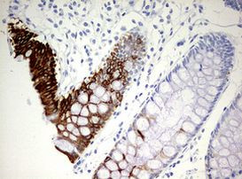 KRT20 Antibody in Immunohistochemistry (Paraffin) (IHC (P))