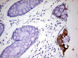 KRT20 Antibody in Immunohistochemistry (Paraffin) (IHC (P))