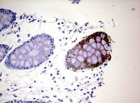 KRT20 Antibody in Immunohistochemistry (Paraffin) (IHC (P))