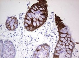 KRT20 Antibody in Immunohistochemistry (Paraffin) (IHC (P))